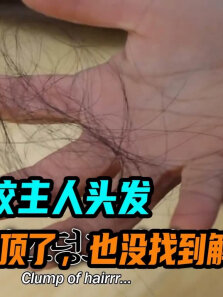 狗狗天天咬主人头发，女人都快秃顶了，也没找到解决办法